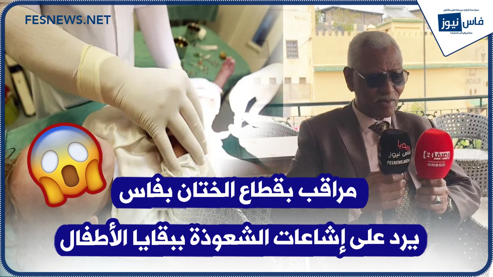 Unprecedented Statement: Circumcision Sector Inspector in Fez Condemns Rumors of Suspicious Practices — “They’re Using Children’s Foreskins for Witchcraft” (+Video)